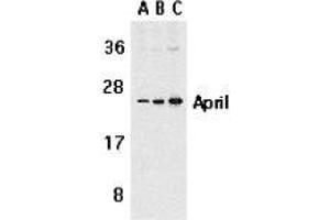 Western blot analysis of APRIL expression in Jurkat cells with AP30075PU-N APRIL antibody at 1 μg/ml (A), 2 μg/ml (B), and 4 μg/ml (C).