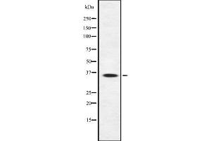 Western blot analysis SIRT4 using Jurkat whole cell lysates (SIRT4 antibody  (Internal Region))
