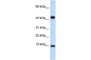 WB Suggested Anti-CCL8 Antibody Titration:  0. (CCL8 antibody  (Middle Region))