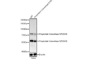 Western blot analysis of extracts of HeLa cells, using Proprotein Convertase 9(PCSK9) antibody  at 1:1000 dilution. (PCSK9 antibody)