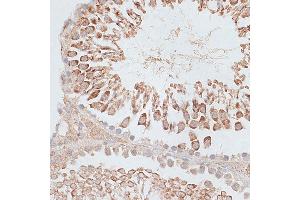 Immunohistochemistry of paraffin-embedded Rat testis using KIF2C/MCAK antibody (ABIN6128155, ABIN6142869, ABIN6142870 and ABIN6221103) at dilution of 1:100 (40x lens). (KIF2C antibody  (AA 1-190))