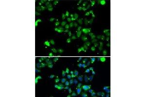 Immunofluorescence analysis of A-549 cells using U2AF1L4 Polyclonal Antibody (Splicing factor U2AF 26 kDa subunit (U2AF1L4) antibody)