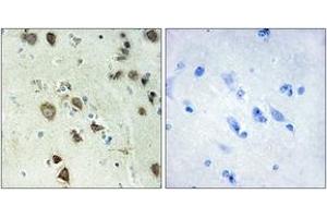 Immunohistochemistry (IHC) image for anti-Ribosomal Protein S6 Kinase, 90kDa, Polypeptide 6 (RPS6KA6) (AA 661-710) antibody (ABIN1534185)