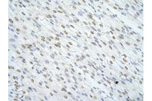 Rabbit Anti-SF1 antibody   Paraffin Embedded Tissue: Human Heart cell Cellular Data: cardiac cell of renal tubule Antibody Concentration: 4. (Splicing Factor 1 antibody  (N-Term))