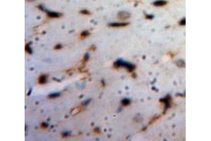 IHC-P analysis of Heart tissue, with DAB staining. (ANGPTL1 antibody  (AA 271-491))