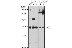 Western blot analysis of extracts of various cell lines, using MGLL antibody (ABIN6128306, ABIN6143823, ABIN6143824 and ABIN6222352) at 1:1000 dilution. (MGLL antibody  (AA 1-303))