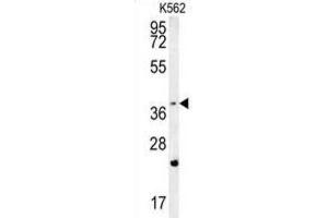 Western Blotting (WB) image for anti-F-Box and WD Repeat Domain Containing 12 (FBXW12) antibody (ABIN2995589) (FBXW12 antibody)