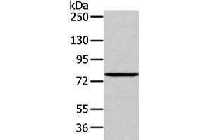 Gel: 6 % SDS-PAGE, Lysate: 60 μg, Lane: 293T cell, Primary antibody: ABIN7193043(WDR91 Antibody) at dilution 1/400 dilution, Secondary antibody: Goat anti rabbit IgG at 1/8000 dilution, Exposure time: 1 minute (WDR91 antibody)
