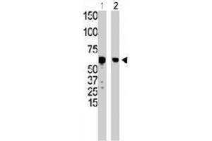 The GCK polyclonal antibody  is used in Western blot to detect GCK in HepG2 cell lysate (Lane 1) and mouse liver tissue lysate (Lane 2) . (GCK antibody  (N-Term))