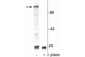 Western blot of UV treated human Jurkat cell lysate showing specific immunolabeling of the ~74 kDa Raf-1 protein phosphorylated at Ser301 in the first lane (-). (RAF1 antibody  (pSer301))