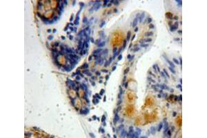 Used in DAB staining on fromalin fixed paraffin-embedded Intestine tissue (VWA3A antibody  (AA 981-1176))