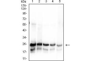 Western blot analysis using SARS-Cov2-NP1 mAb against human SARS-Cov2-N (AA: 1-180) recombinant protein. (SARS-Cov2-NP1 (AA 1-180) antibody)