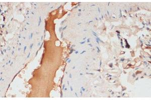 Immunohistochemistry of paraffin-embedded Human lung using APOC1 Polyclonal Antibody at dilution of 1:100 (40x lens). (APOC1 antibody)