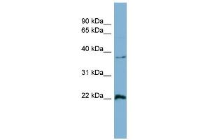 WB Suggested Anti-RAN Antibody Titration: 0. (RAN antibody  (Middle Region))