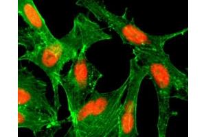 ICC/IF staining of HeLa cells treated with sodium butyrate using recombinant H4K12ac antibody (red).