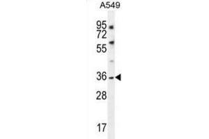 Western Blotting (WB) image for anti-Potassium Channel Subfamily K Member 1 (KCNK1) antibody (ABIN2996574)