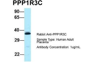 Host: Rabbit  Target Name: PPP1R3C  Sample Tissue: Human Adult Placenta  Antibody Dilution: 1. (PPP1R3C antibody  (N-Term))