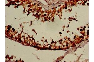 Immunohistochemistry of paraffin-embedded human testis tissue using ABIN7161039 at dilution of 1:100 (NANOS3 antibody  (AA 21-192))