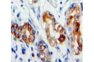 Used in DAB staining on fromalin fixed paraffin-embedded Stomach tissue (CD36 antibody  (AA 187-428))