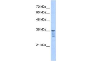 Western Blotting (WB) image for anti-Leucine Zipper Transcription Factor-Like 1 (LZTFL1) antibody (ABIN2463178) (LZTFL1 antibody)