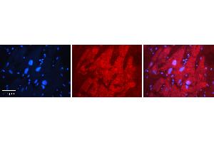 Rabbit Anti-MBNL1 Antibody   Formalin Fixed Paraffin Embedded Tissue: Human heart Tissue Observed Staining: Cytoplasmic, nucleus Primary Antibody Concentration: 1:100 Other Working Concentrations: N/A Secondary Antibody: Donkey anti-Rabbit-Cy3 Secondary Antibody Concentration: 1:200 Magnification: 20X Exposure Time: 0. (MBNL1 antibody  (C-Term))