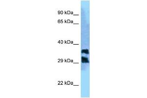 WB Suggested Anti-PGP Antibody Titration: 1. (PGP antibody  (C-Term))