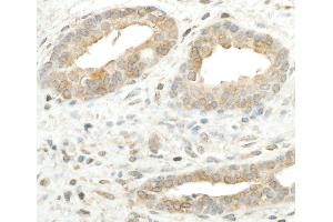 Immunohistochemistry (IHC) image for anti-Ribosomal Protein S5 (RPS5) (AA 1-50) antibody (ABIN7455001) (RPS5 antibody  (AA 1-50))