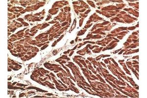 Immunohistochemical analysis of paraffin-embedded Human Heart Tissue using VE-Cadherin Mouse mAb diluted at 1:200. (Cadherin 5 antibody  (AA 670-750))