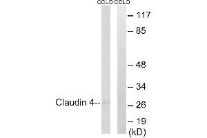 Immunohistochemistry analysis of paraffin-embedded human brain tissue, using Claudin 4 (Ab-208) antibody. (Claudin 4 antibody  (Internal Region))