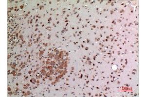 Immunohistochemistry (IHC) analysis of paraffin-embedded Rat Brain, antibody was diluted at 1:100. (FGF20 antibody  (Internal Region))