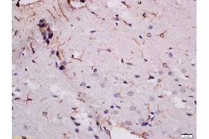 Formalin-fixed and paraffin embedded rat brain labeled with Rabbit Anti-MDGA2 Polyclonal Antibody, Unconjugated  at 1:200 followed by conjugation to the secondary antibody and DAB staining