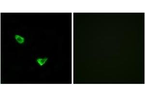 Immunofluorescence analysis of MCF7 cells, using CHSY2 Antibody. (CHPF antibody  (AA 631-680))