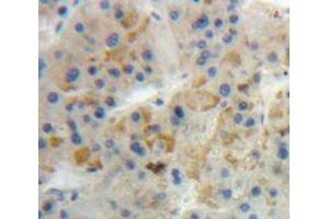 Used in DAB staining on fromalin fixed paraffin-embedded Liver tissue (GIP antibody  (AA 22-153))