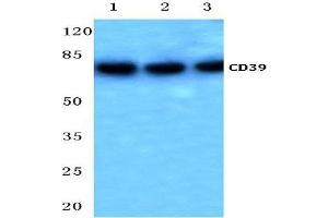 Western blot analysis of CD39 Antibody in HeLa cell lysate (Lane 1), Mouse spleen tissue lysate (Lane 2) and in Rat liver tissue lysate (Lane 3). (CD39 antibody)