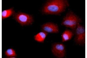 Immunofluorescence (IF) image for anti-Cofilin 1 (CFL1) (AA 1-166) antibody (APC) (ABIN5566999)