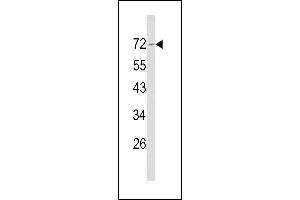Western blot analysis of Merlin Antibody (N-term) (ABIN390756 and ABIN2841014) in NCI- cell line lysates (35 μg/lane). (Merlin antibody  (N-Term))