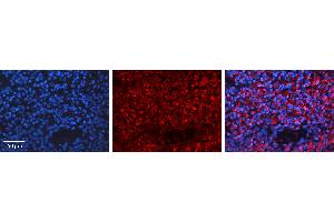 Rabbit Anti-BRCA1 Antibody Catalog Number: ARP30434_P050 Formalin Fixed Paraffin Embedded Tissue: Human Lymph Node Tissue Observed Staining: Cytoplasm Primary Antibody Concentration: 1:100 Other Working Concentrations: N/A Secondary Antibody: Donkey anti-Rabbit-Cy3 Secondary Antibody Concentration: 1:200 Magnification: 20X Exposure Time: 0. (BRCA1 antibody  (N-Term))