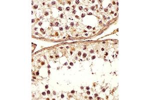 Immunohistochemical analysis of paraffin-embedded H. (DEFB107A antibody  (C-Term))