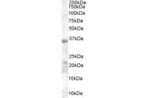 Western Blotting (WB) image for anti-Calcium Channel, Voltage-Dependent, alpha 2/delta Subunit 4 (CACNA2D4) (Middle Region) antibody (ABIN2790200) (CACNA2D4 antibody  (Middle Region))