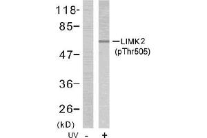 Image no. 1 for anti-LIM Domain Kinase 2 (LIMK2) (pThr505) antibody (ABIN196832) (LIMK2 antibody  (pThr505))