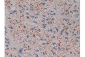 Immunohistochemistry (IHC) image for anti-Kallikrein 2 (KLK2) (AA 19-261) antibody (ABIN7435352)