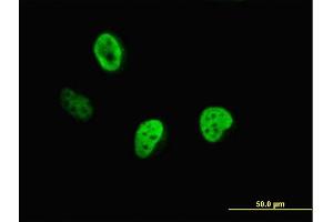 Immunofluorescence of monoclonal antibody to CUTL1 on HeLa cell. (CUX1 antibody  (AA 521-620))