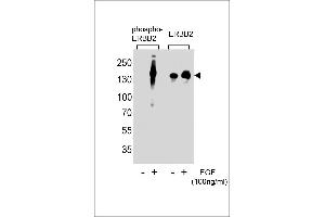 Western blot analysis of extracts from A431 cells,untreated or treated with EGF,100 ng/mL , using phospho-ERBB2-(left) or ERBB2 Antibody (right)