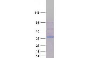 Validation with Western Blot (NEK6 Protein (Transcript Variant 5) (Myc-DYKDDDDK Tag))