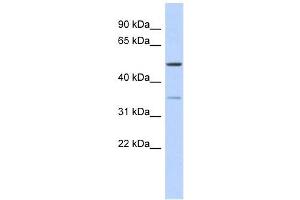 CETP antibody used at 1 ug/ml to detect target protein.