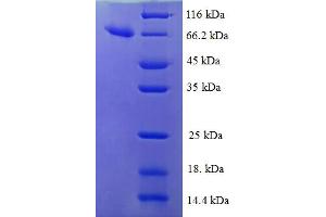 IDH3B Protein (AA 35-385) (GST tag)