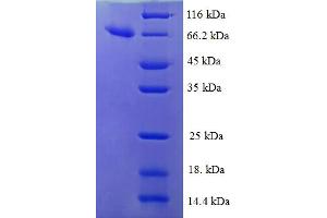 SDS-PAGE (SDS) image for Isocitrate Dehydrogenase 3 (NAD+) beta (IDH3B) (AA 35-385) protein (GST tag) (ABIN4974627)