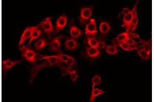 ABIN6274881 staining HuvEc by IF/ICC. (ABCA8 antibody  (Internal Region))