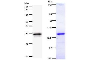 Left: UBP1 staining. (UBP1 antibody)