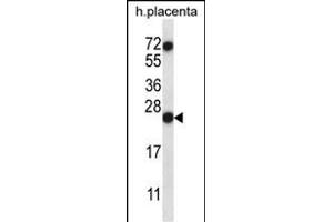 RNASE8 Antibody (C-term) (ABIN657386 and ABIN2846428) western blot analysis in human placenta tissue lysates (35 μg/lane). (RNASE8 antibody  (C-Term))